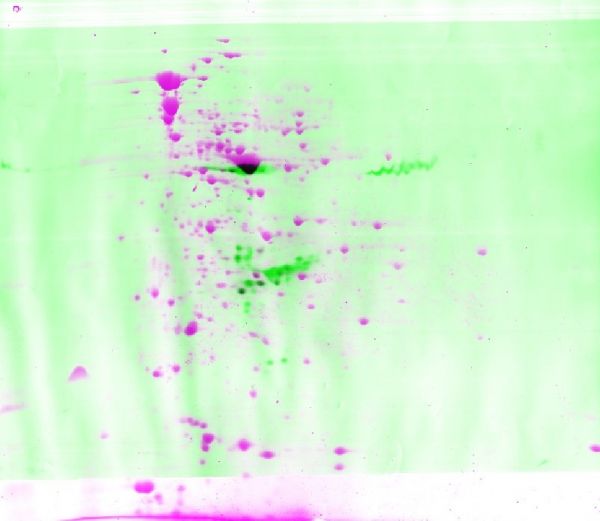 L’analyse des protéines sur gel : Western Blot et Gel à 2-D