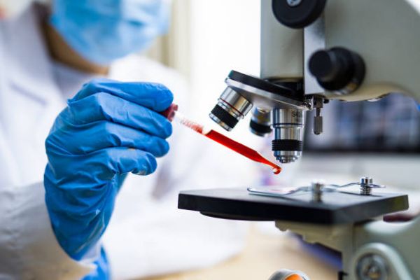 La prise d'essai et les dilutions des produits en vue de leur analyse microbiologique