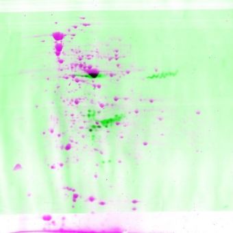 L’analyse des protéines sur gel : Western Blot et Gel à 2-D